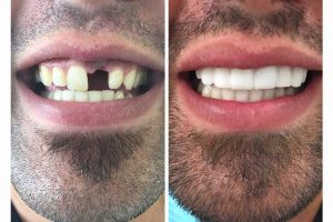 15439877_379797509030990_4457511837971371596_n