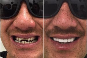 22730302_549860578691348_4595156065922063780_n