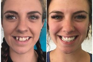 25299370_577435372600535_5958089224729103507_n