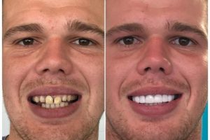 26733775_594768474200558_7754139063466913253_n