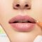 Dermal-Fillers-Mornington-Peninsula